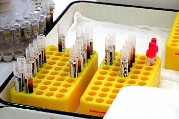 В Калининградской области стартует исследование популяционного иммунитета к COVID-19