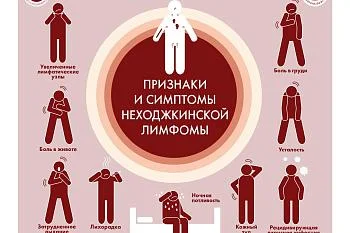 Признаки и симптомы Неходжинской лимфомы