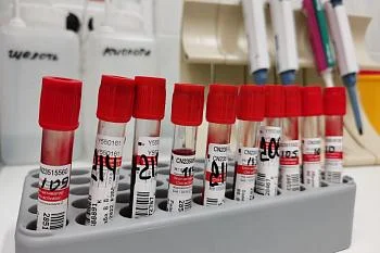 Прием анализов в ГДП