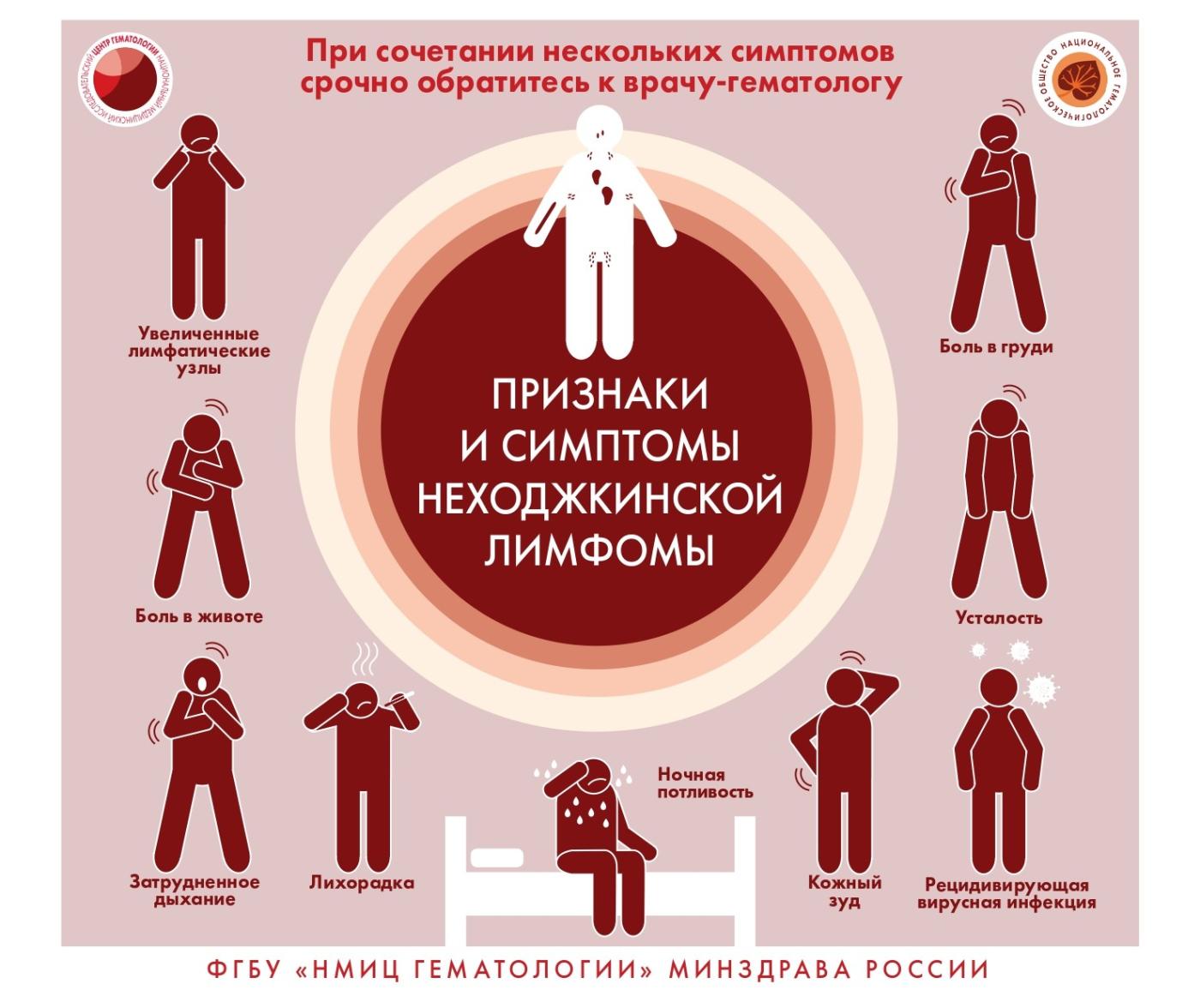 Признаки и симптомы Неходжинской лимфомы